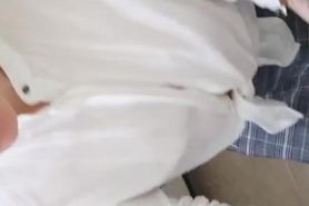 Burns Started after Working